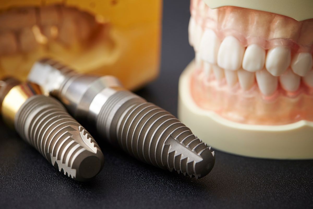 Dental implant bolt 