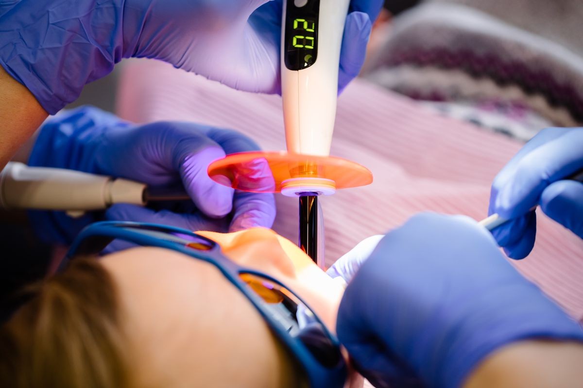 Dentist performing dental filling procedure to a little girl in pediatric dental clinic with a help of assistant. Assistant using dental ultraviolet curing light for filling polymerization